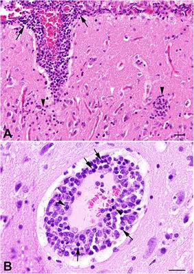 Meningoencephalomyelitis of Unknown Origin in Cats: A Case Series Describing Clinical and Pathological Findings